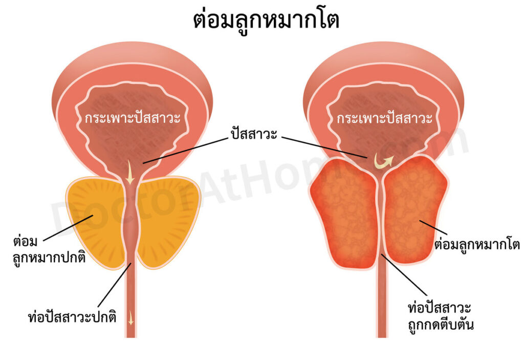 รูปภาพนี้มี Alt แอตทริบิวต์เป็นค่าว่าง ชื่อไฟล์คือ 143--865-2-1-1024x707.jpg